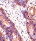 PSMB7 Antibody (Center)